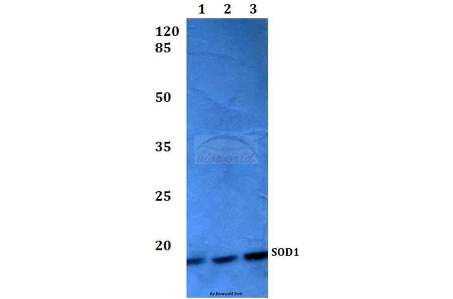 Anti-SOD1 (L85) Antibody from Bioworld Technology (BS2915) - Antibodies.com