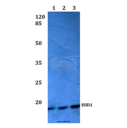 Anti-SOD1 (L85) Antibody from Bioworld Technology (BS2915) - Antibodies.com