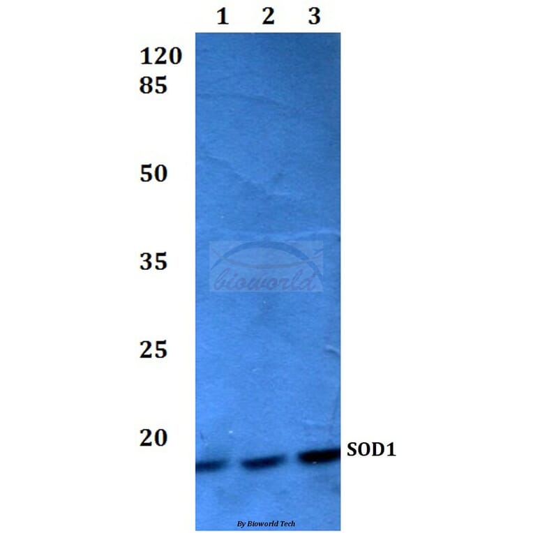 Anti-SOD1 (L85) Antibody from Bioworld Technology (BS2915) - Antibodies.com