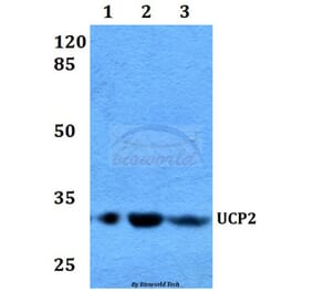 Anti-UCP2 (H113) Antibody from Bioworld Technology (BS2917) - Antibodies.com