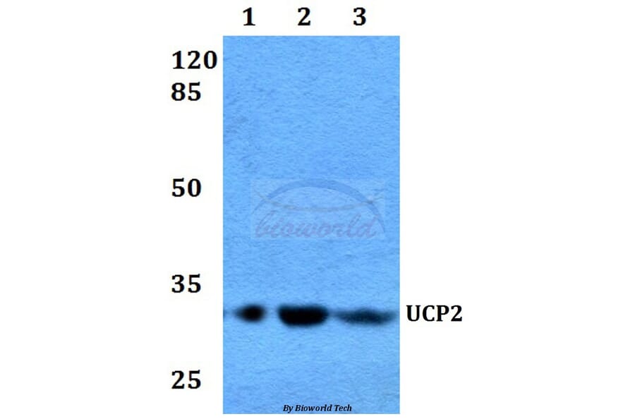 Anti-UCP2 (H113) Antibody from Bioworld Technology (BS2917) - Antibodies.com