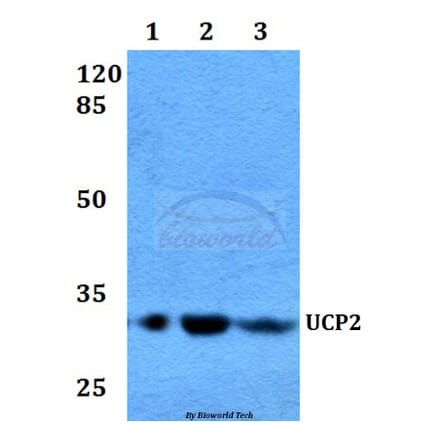 Anti-UCP2 (H113) Antibody from Bioworld Technology (BS2917) - Antibodies.com