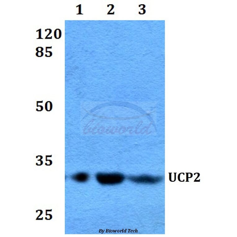Anti-UCP2 (H113) Antibody from Bioworld Technology (BS2917) - Antibodies.com