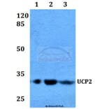 Anti-UCP2 (H113) Antibody from Bioworld Technology (BS2917) - Antibodies.com