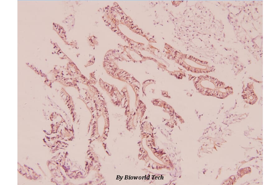 Anti-UCP2 (H113) Antibody from Bioworld Technology (BS2917) - Antibodies.com