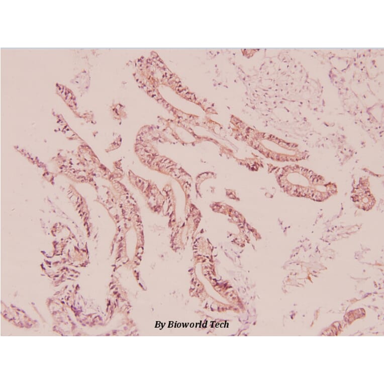 Anti-UCP2 (H113) Antibody from Bioworld Technology (BS2917) - Antibodies.com