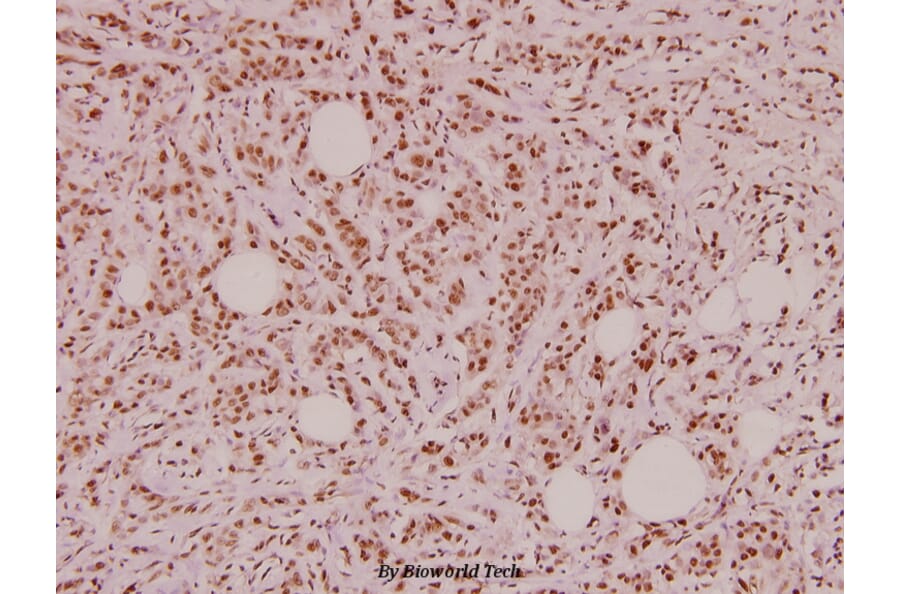 Anti-VIP (V120) Antibody from Bioworld Technology (BS2919) - Antibodies.com