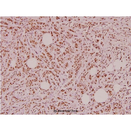 Anti-VIP (V120) Antibody from Bioworld Technology (BS2919) - Antibodies.com