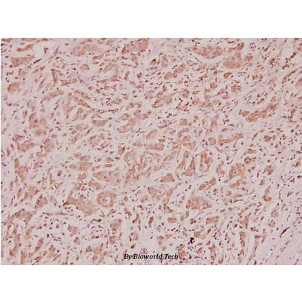 Anti-Calcitonin (I78) Antibody from Bioworld Technology (BS2923) - Antibodies.com