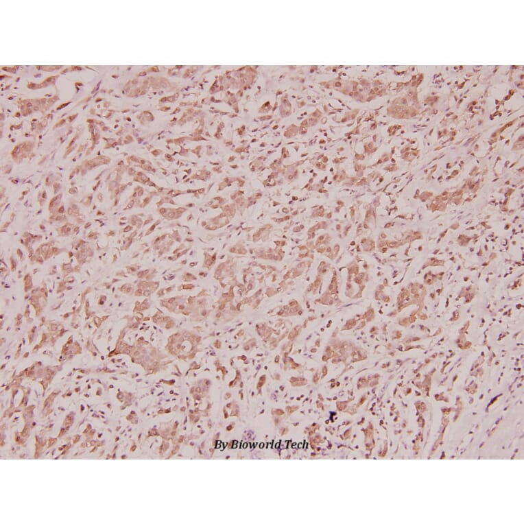 Anti-Calcitonin (I78) Antibody from Bioworld Technology (BS2923) - Antibodies.com