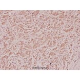 Anti-Calcitonin (I78) Antibody from Bioworld Technology (BS2923) - Antibodies.com