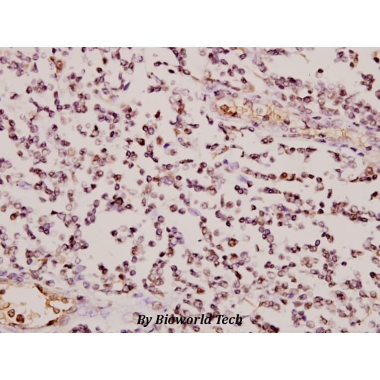 Anti-GCSm-γ (V91) Antibody from Bioworld Technology (BS2927) - Antibodies.com