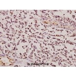 Anti-GCSm-γ (V91) Antibody from Bioworld Technology (BS2927) - Antibodies.com