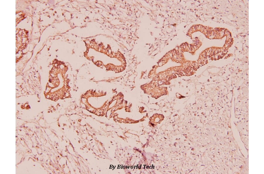 Anti-Ghrelin (K47) Antibody from Bioworld Technology (BS2930) - Antibodies.com