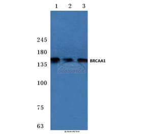 Anti-BRCAA1 (D810) Antibody from Bioworld Technology (BS2935) - Antibodies.com