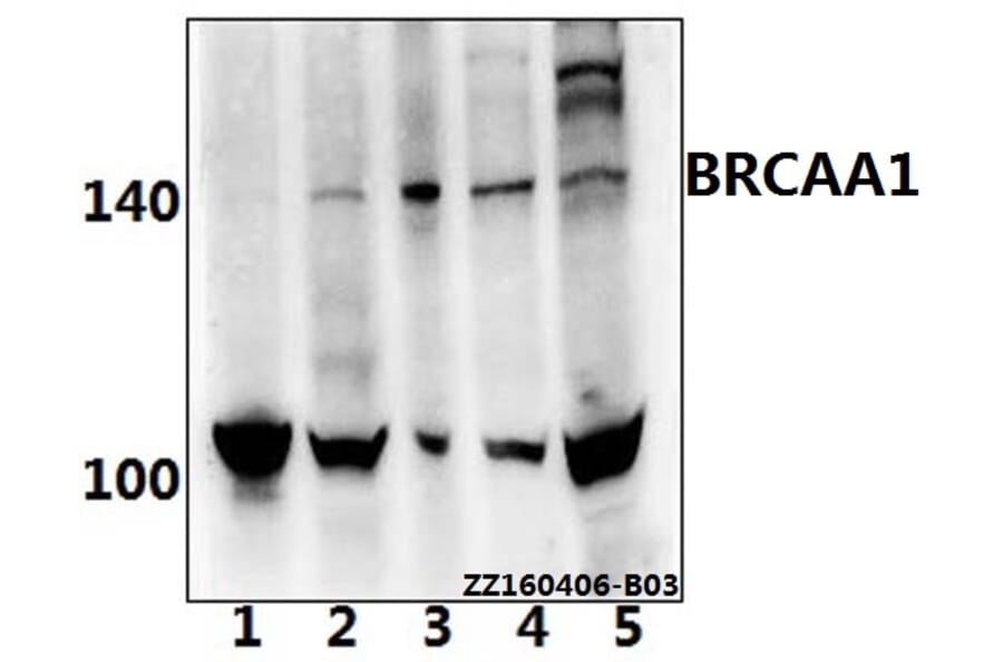 Anti-BRCAA1 (D810) Antibody from Bioworld Technology (BS2935) - Antibodies.com