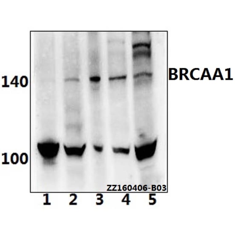 Anti-BRCAA1 (D810) Antibody from Bioworld Technology (BS2935) - Antibodies.com