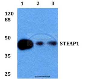 Anti-STEAP1 (D31) Antibody from Bioworld Technology (BS2937) - Antibodies.com