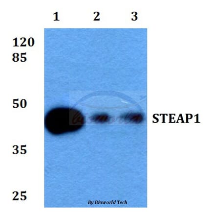 Anti-STEAP1 (D31) Antibody from Bioworld Technology (BS2937) - Antibodies.com