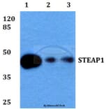 Anti-STEAP1 (D31) Antibody from Bioworld Technology (BS2937) - Antibodies.com