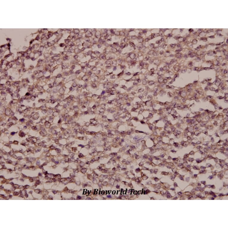 Anti-STEAP1 (D31) Antibody from Bioworld Technology (BS2937) - Antibodies.com