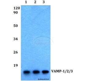 Anti-VAMP-1/2/3 (D70) Antibody from Bioworld Technology (BS2938) - Antibodies.com