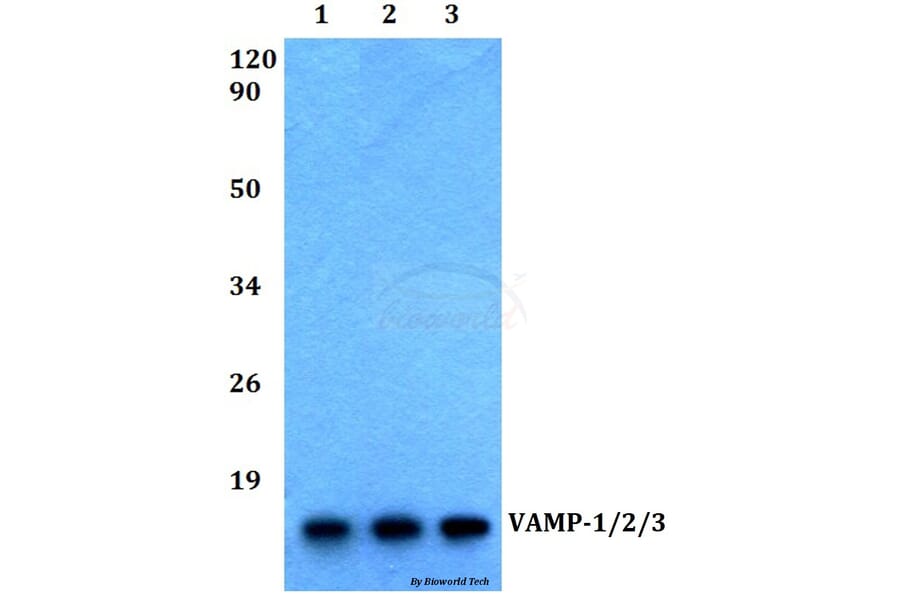 Anti-VAMP-1/2/3 (D70) Antibody from Bioworld Technology (BS2938) - Antibodies.com