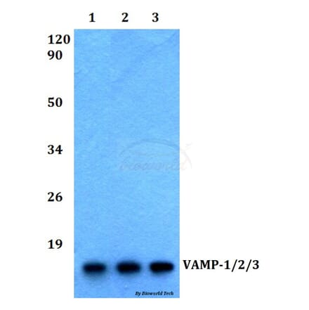 Anti-VAMP-1/2/3 (D70) Antibody from Bioworld Technology (BS2938) - Antibodies.com