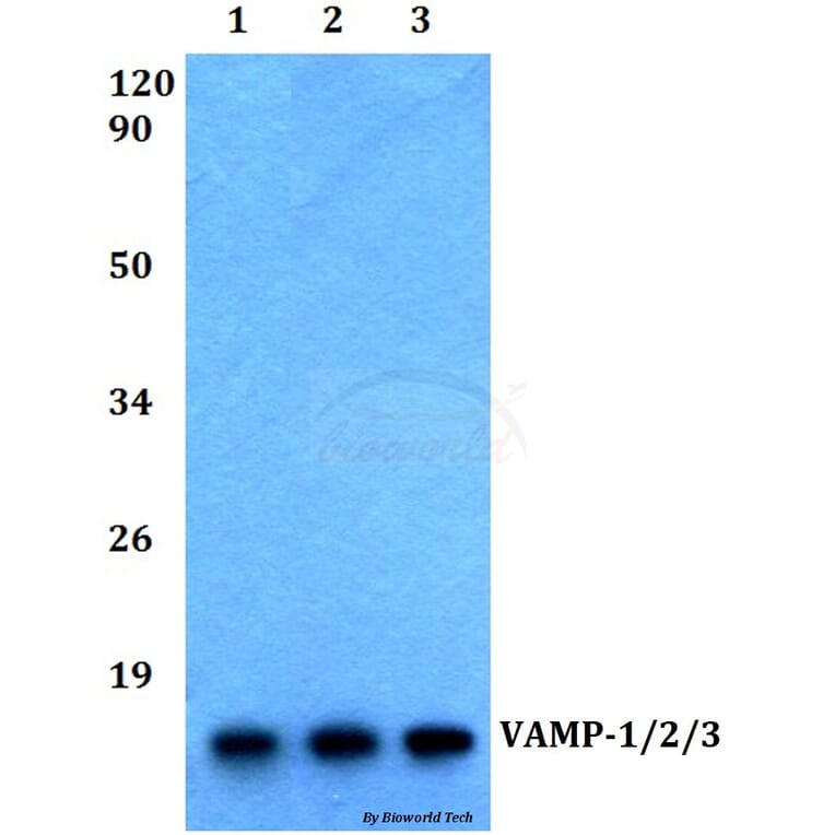 Anti-VAMP-1/2/3 (D70) Antibody from Bioworld Technology (BS2938) - Antibodies.com
