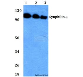 Anti-Synphilin-1 (R846) Antibody from Bioworld Technology (BS2939) - Antibodies.com