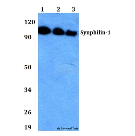 Anti-Synphilin-1 (R846) Antibody from Bioworld Technology (BS2939) - Antibodies.com