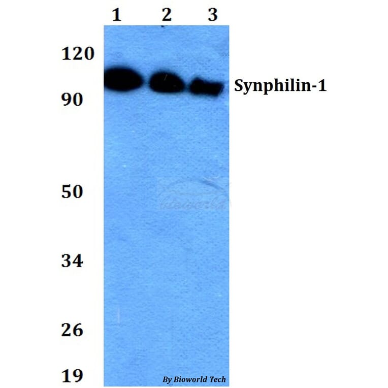 Anti-Synphilin-1 (R846) Antibody from Bioworld Technology (BS2939) - Antibodies.com
