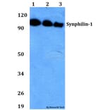 Anti-Synphilin-1 (R846) Antibody from Bioworld Technology (BS2939) - Antibodies.com