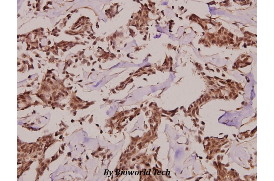 Anti-Synphilin-1 (R846) Antibody from Bioworld Technology (BS2939) - Antibodies.com