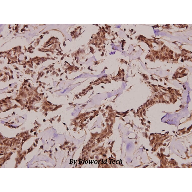 Anti-Synphilin-1 (R846) Antibody from Bioworld Technology (BS2939) - Antibodies.com