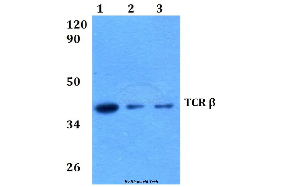 Anti-TCR β (K115) Antibody from Bioworld Technology (BS2943) - Antibodies.com