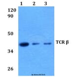 Anti-TCR β (K115) Antibody from Bioworld Technology (BS2943) - Antibodies.com