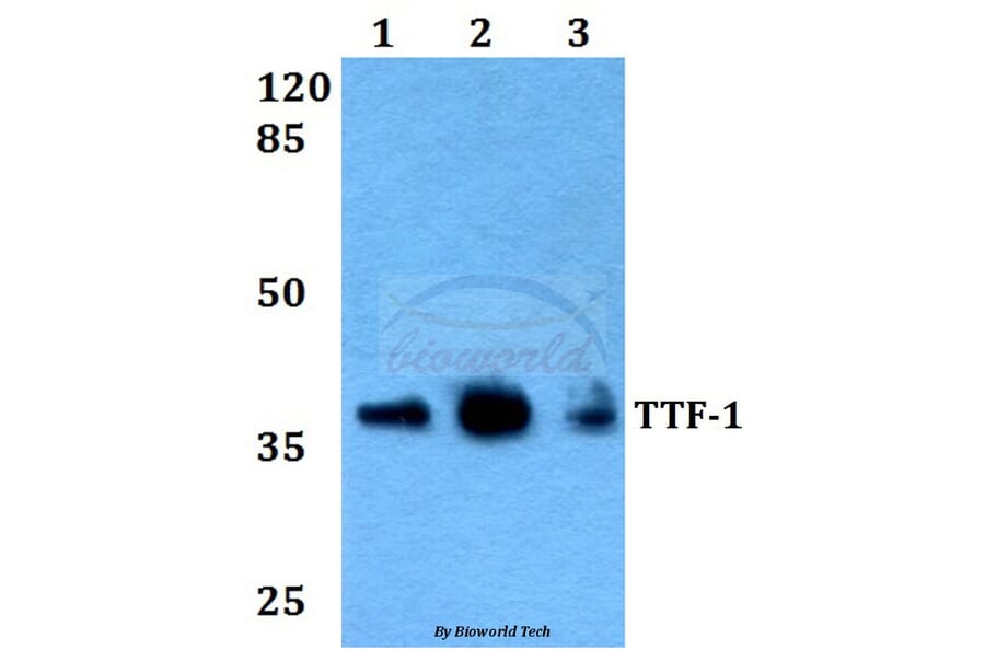Anti-TTF-1 (V27) Antibody from Bioworld Technology (BS2947) - Antibodies.com