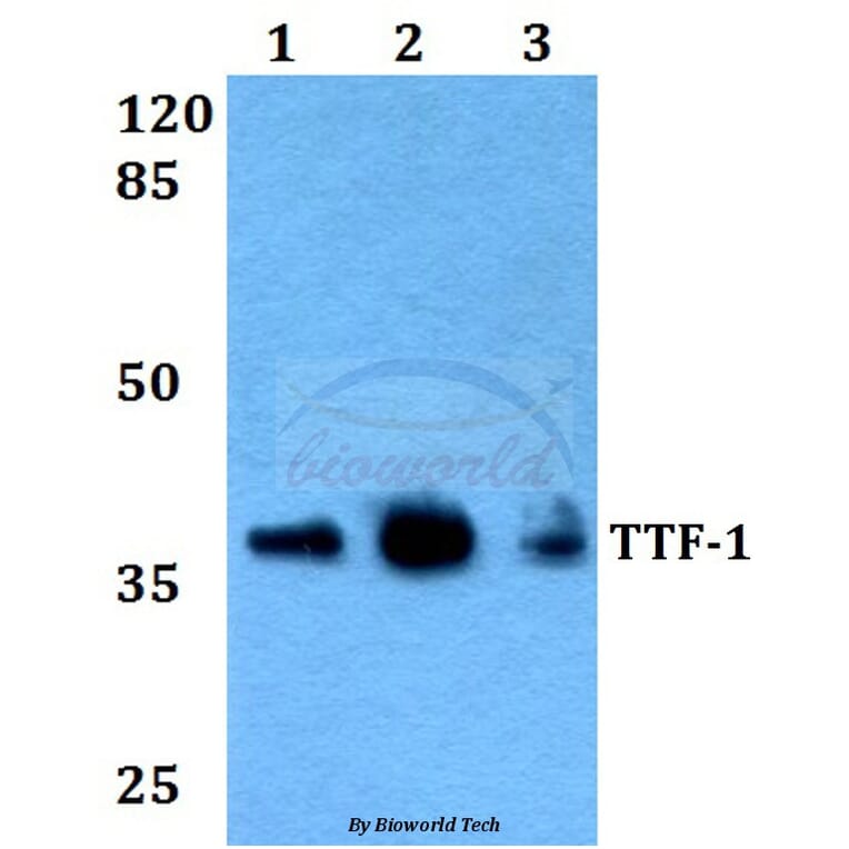 Anti-TTF-1 (V27) Antibody from Bioworld Technology (BS2947) - Antibodies.com