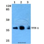 Anti-TTF-1 (V27) Antibody from Bioworld Technology (BS2947) - Antibodies.com
