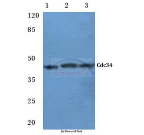 Anti-Cdc34 (D163) Antibody from Bioworld Technology (BS2949) - Antibodies.com