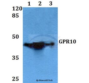 Anti-GPR10 (Q223) Antibody from Bioworld Technology (BS2958) - Antibodies.com