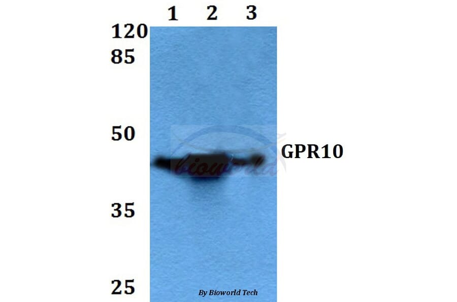 Anti-GPR10 (Q223) Antibody from Bioworld Technology (BS2958) - Antibodies.com