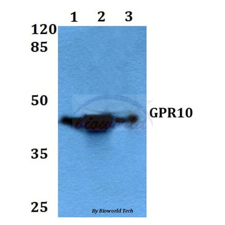Anti-GPR10 (Q223) Antibody from Bioworld Technology (BS2958) - Antibodies.com