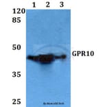 Anti-GPR10 (Q223) Antibody from Bioworld Technology (BS2958) - Antibodies.com