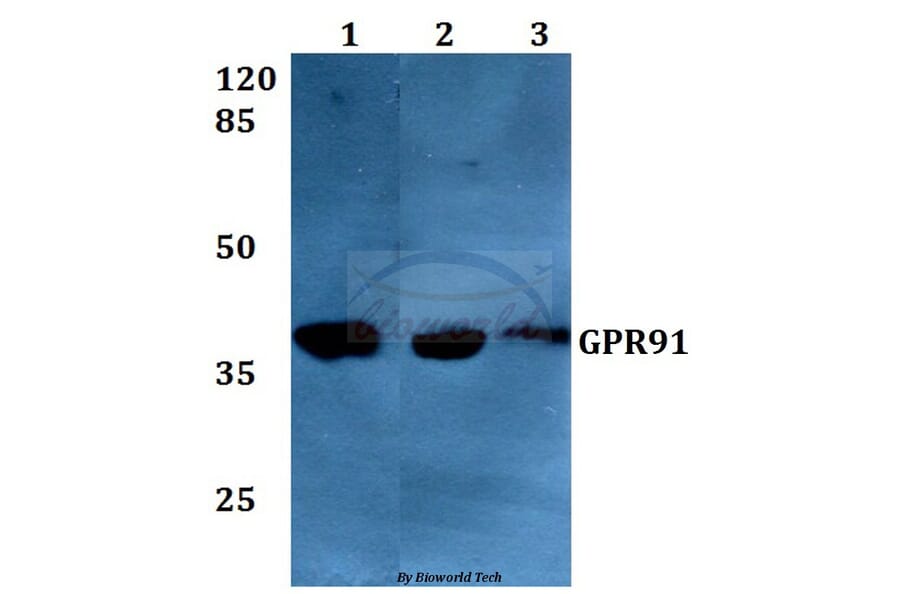 Anti-GPR91 (A135) Antibody from Bioworld Technology (BS2961) - Antibodies.com