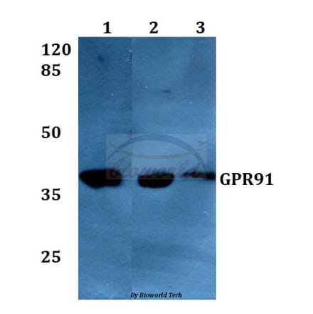 Anti-GPR91 (A135) Antibody from Bioworld Technology (BS2961) - Antibodies.com