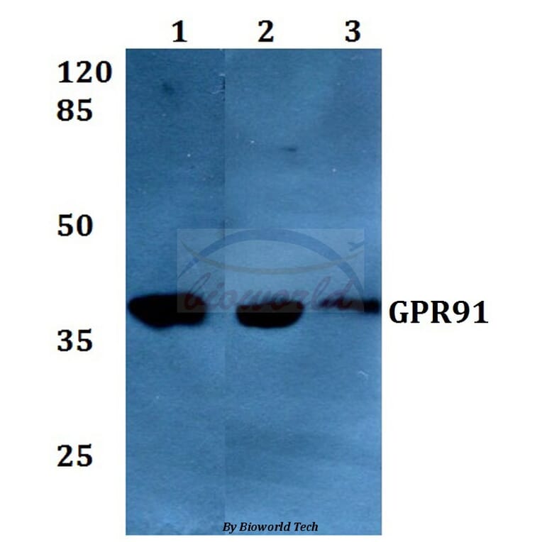 Anti-GPR91 (A135) Antibody from Bioworld Technology (BS2961) - Antibodies.com