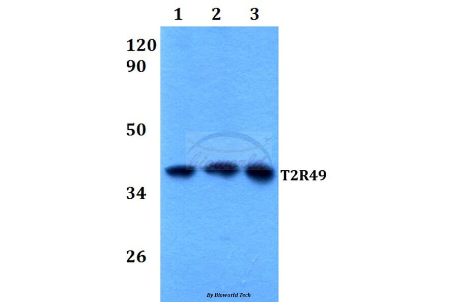 Anti-T2R49 (V129) Antibody from Bioworld Technology (BS2963) - Antibodies.com