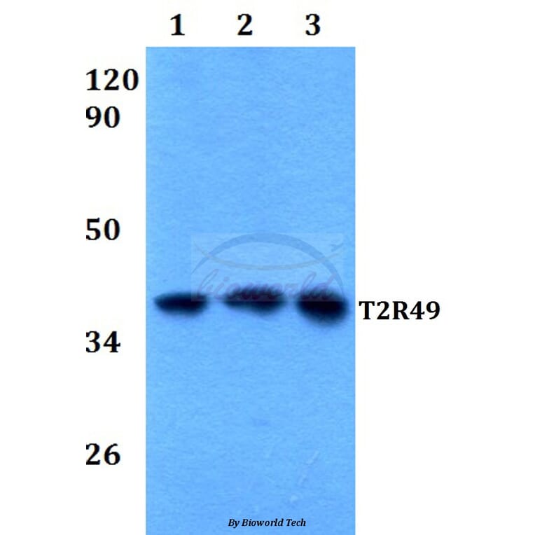Anti-T2R49 (V129) Antibody from Bioworld Technology (BS2963) - Antibodies.com